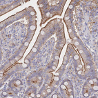 Anti-F11R Antibody