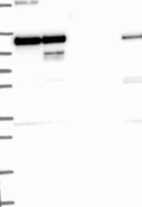 Anti-HK2 Antibody