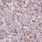 Immunohistochemical staining of human placenta shows high expression.