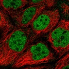 Immunofluorescent staining of human cell line CACO-2 shows localization to nucleoplasm.