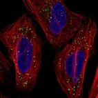 Anti-TMEM54 Antibody