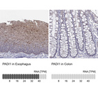 Anti-PADI1 Antibody