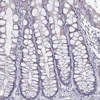 Anti-PADI1 Antibody