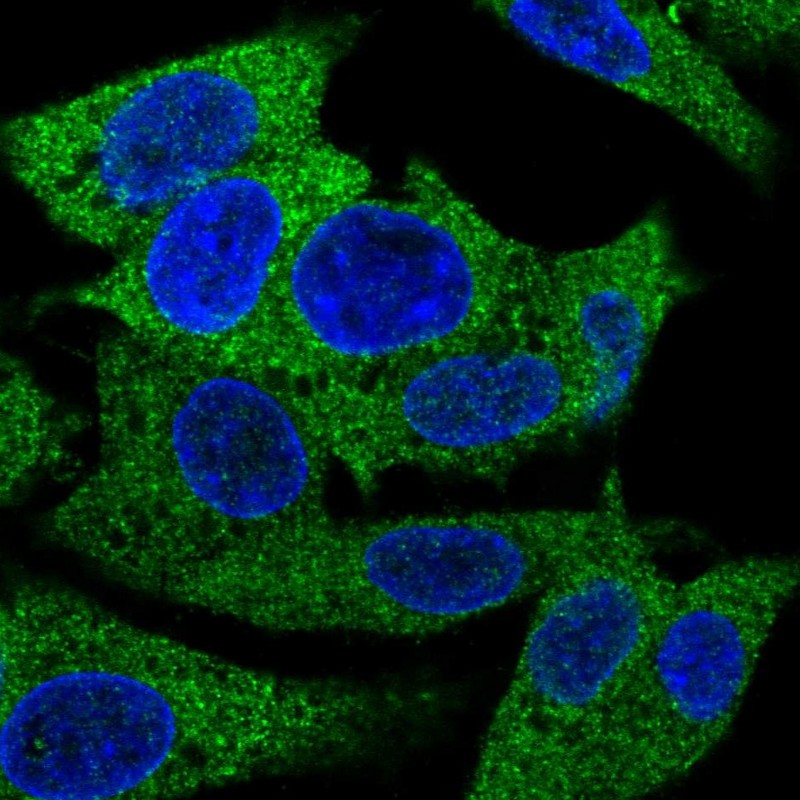 Anti-PRPSAP1 Antibody