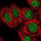 Anti-KCTD1 Antibody