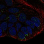 Anti-WNT10B Antibody