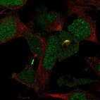 Anti-KATNBL1 Antibody