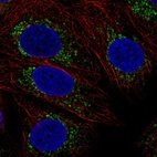 Anti-COX16 Antibody