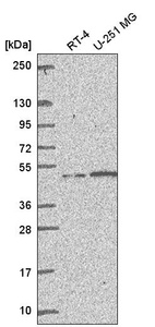 Anti-MSH5 Antibody