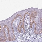 Anti-SLC35E2 Antibody