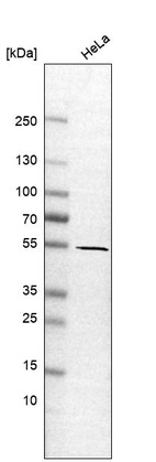 Anti-GLIS2 Antibody