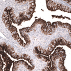 Immunohistochemical staining of human fallopian tube shows strong membranous-cytoplasmic positivity in glandular cells.