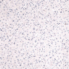 Immunohistochemical staining of human liver shows no positivity in hepatocytes as expected.