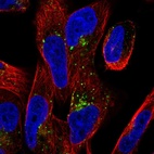 Anti-TMEM123 Antibody