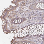 Anti-NKX2-8 Antibody