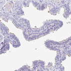 Anti-CFAP69 Antibody