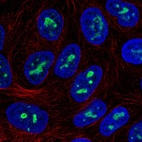 Anti-ZNF713 Antibody