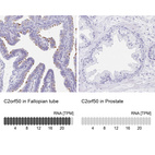 Anti-C2orf50 Antibody