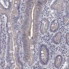 Anti-TMEM198 Antibody