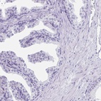 Immunohistochemical staining of human prostate shows low expression as expected.