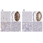 Anti-BFSP2 Antibody