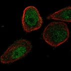 Anti-CHML Antibody