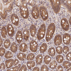 Anti-SLC52A2 Antibody