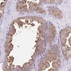 Anti-FAM177B Antibody