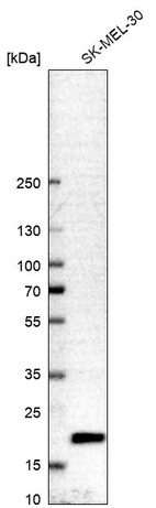 Anti-CNBP Antibody