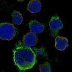 Anti-CCR2 Antibody