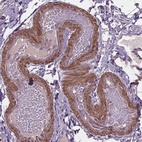 Anti-CLN3 Antibody