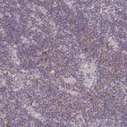 Anti-MT-ND3 Antibody