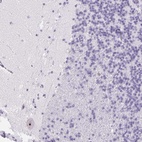 Anti-ST8SIA3 Antibody