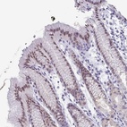 Anti-PYCRL Antibody