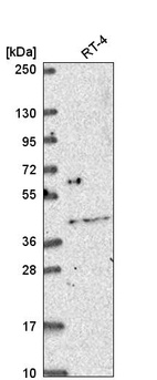 Anti-OSR2 Antibody