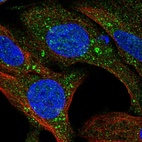 Anti-TMEM159 Antibody