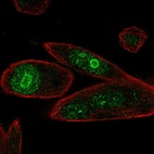 Anti-PHLDA1 Antibody