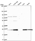 Anti-PRDX3 Antibody