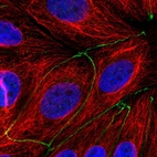 Anti-TMEM186 Antibody