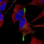 Anti-TGFB3 Antibody