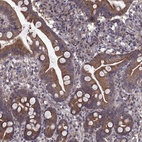 Anti-PMM2 Antibody