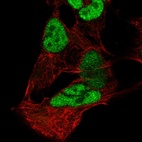 Anti-PAX3 Antibody