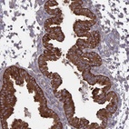 Anti-ARFIP1 Antibody