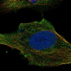 Anti-SLC6A7 Antibody