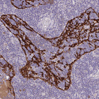 Anti-MARCO Antibody