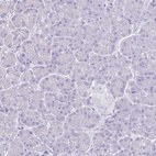 Anti-MARCO Antibody