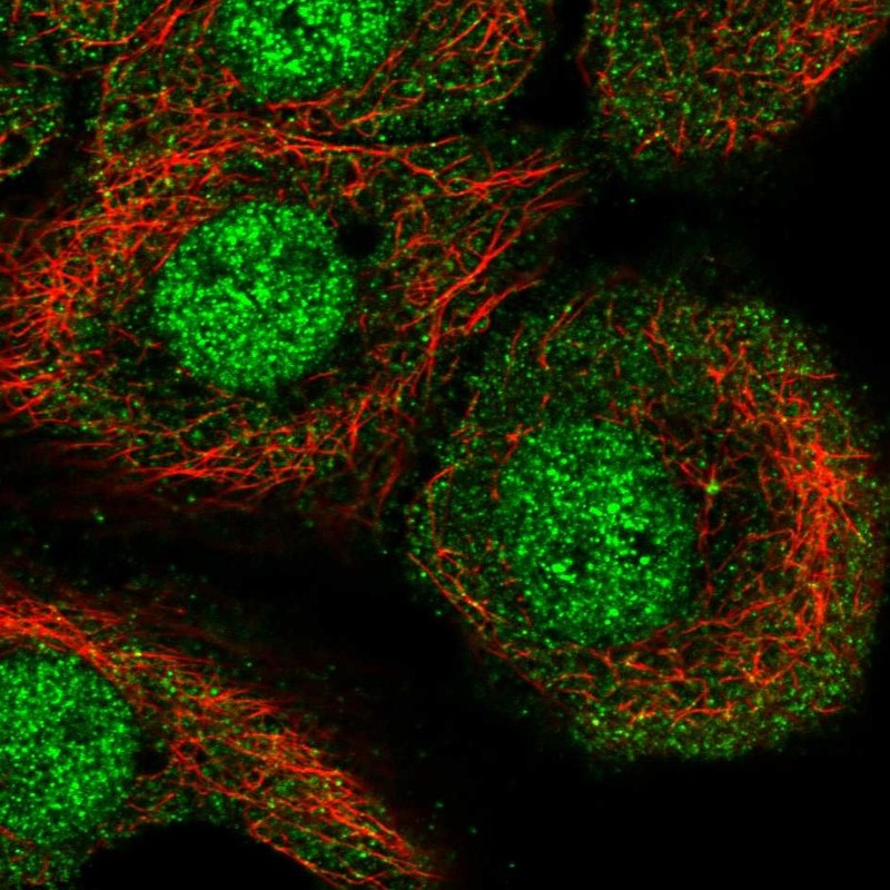 Anti-AKNA Antibody