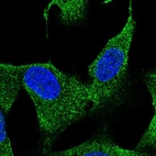 Anti-HS3ST3B1 Antibody