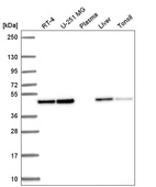 Anti-ANXA7 Antibody