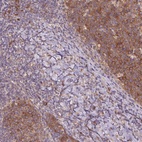 Anti-RRM1 Antibody